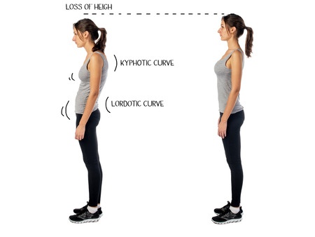 How to Improve Posture